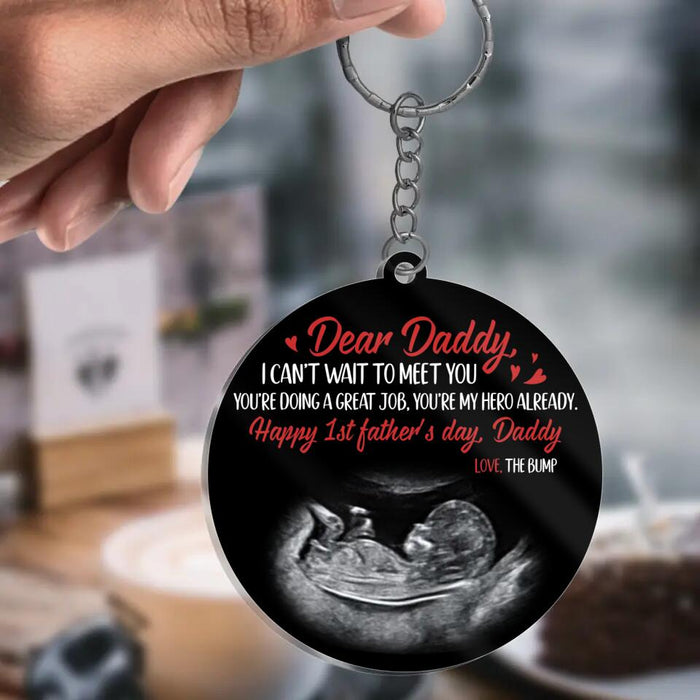 Custom Personalized Father Acrylic Keychain - Upload Photo - Gift Idea for Father's Day - Dear Daddy I Can't Wait To Meet You